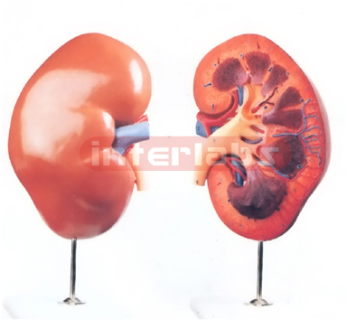 HUMAN KIDNEY, RIGHT